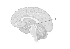 Which hormone is secreted by the gland labeled X?