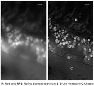 same section of a human retina